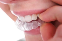 Malatec Chránič proti škrípaniu zubov 2 ks