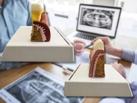 Verk 27614 Anatomický 3D model lidského zubu