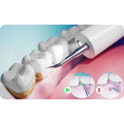Ultrazvukový odstraňovač zubného kameňa Berdsen BD-251, 4 režimy, LED